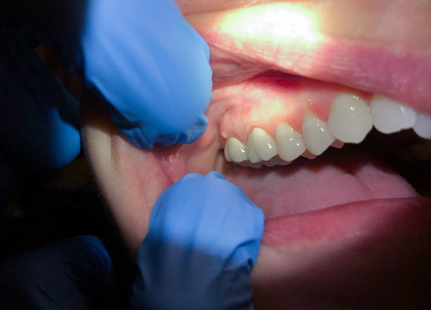 Best Emergency Dental Surgery in Williamston, MI