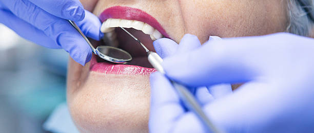 Best Emergency Tooth Extraction in Williamston, MI
